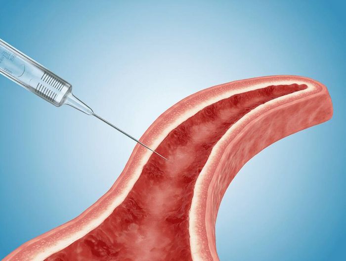 采血针生物相容性检测