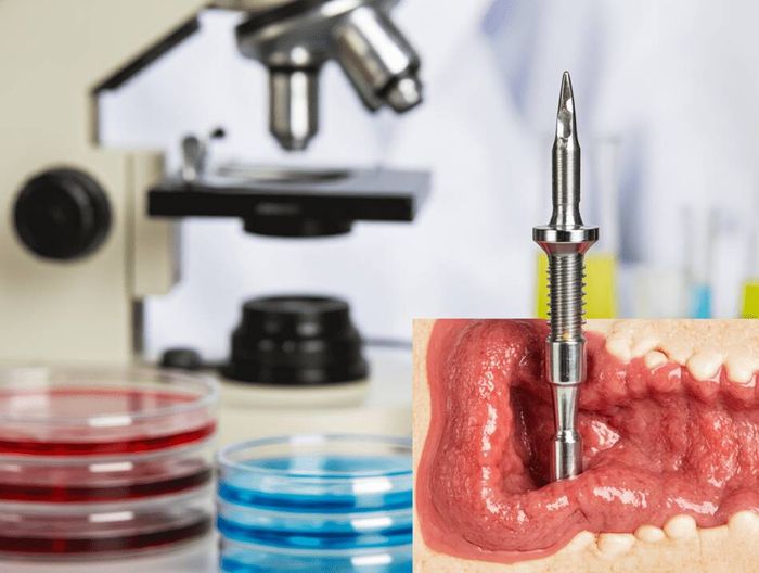 生物可吸收螺钉生物相容性检测